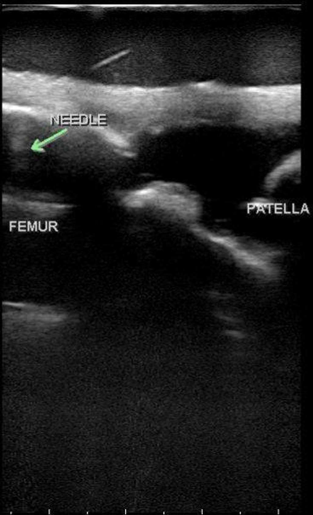 Blue Phantom Musculoskeletal MSK Ultrasound Training Model