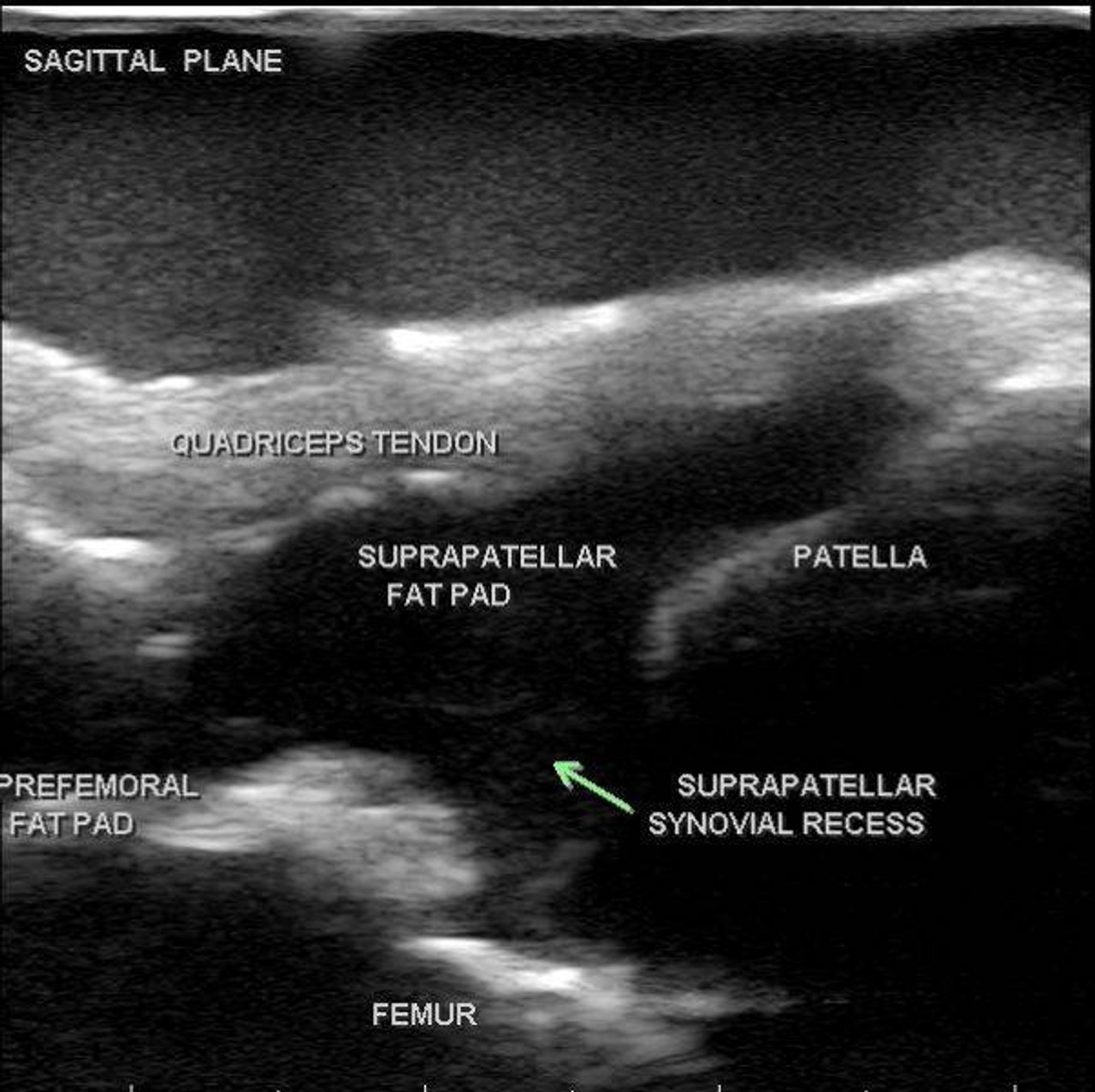 Blue Phantom Musculoskeletal MSK Ultrasound Training Model
