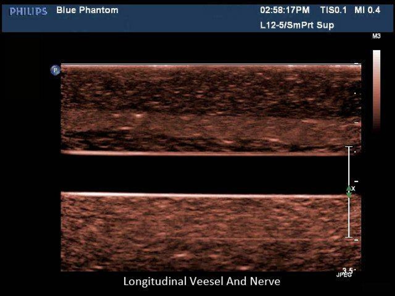 Regional Anesthesia Ultrasound Training Block Model