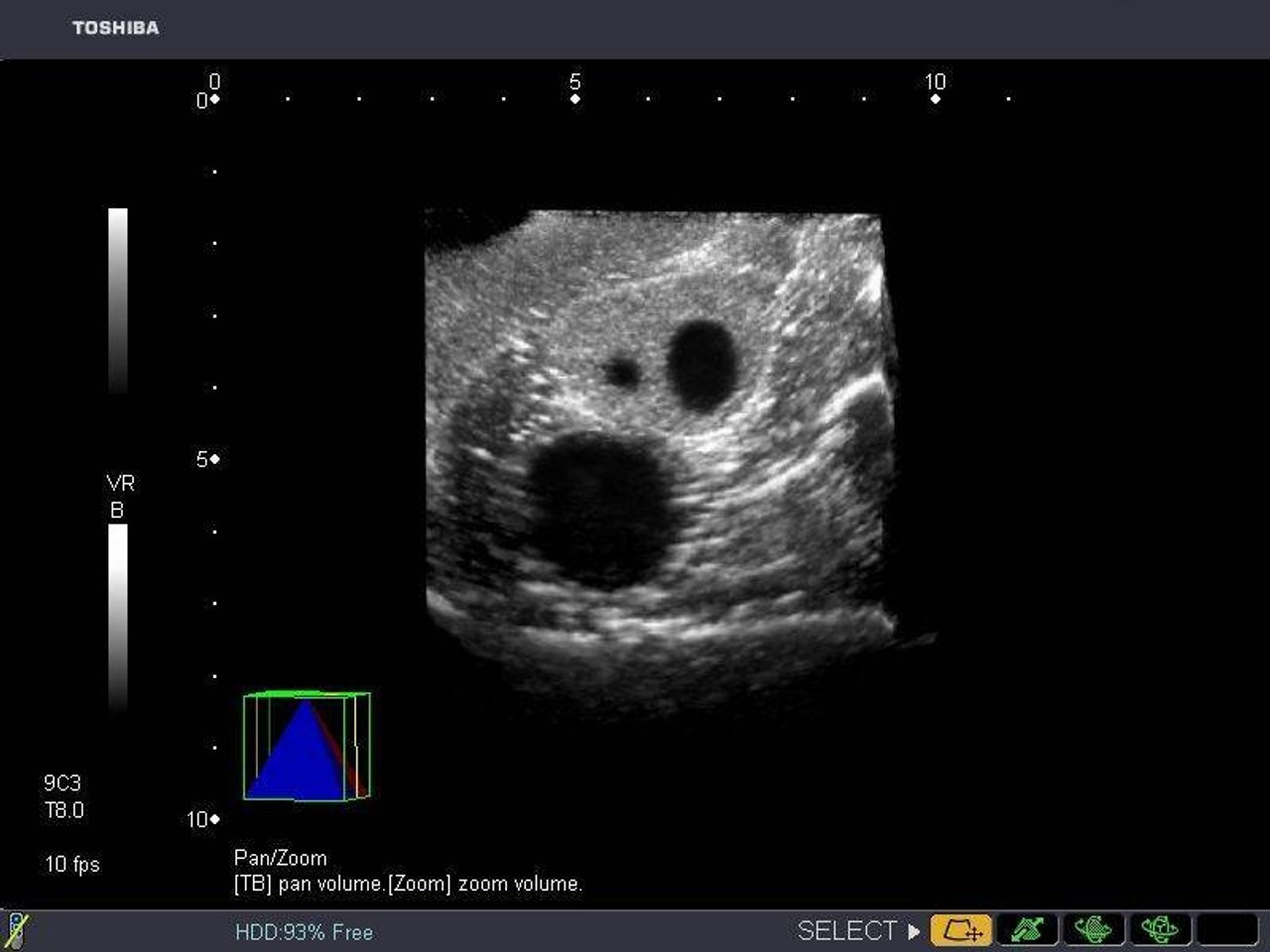 General Pathology Transvaginal Ultrasound Training Model