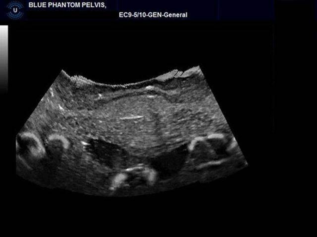 General Pathology Transvaginal Ultrasound Training Model