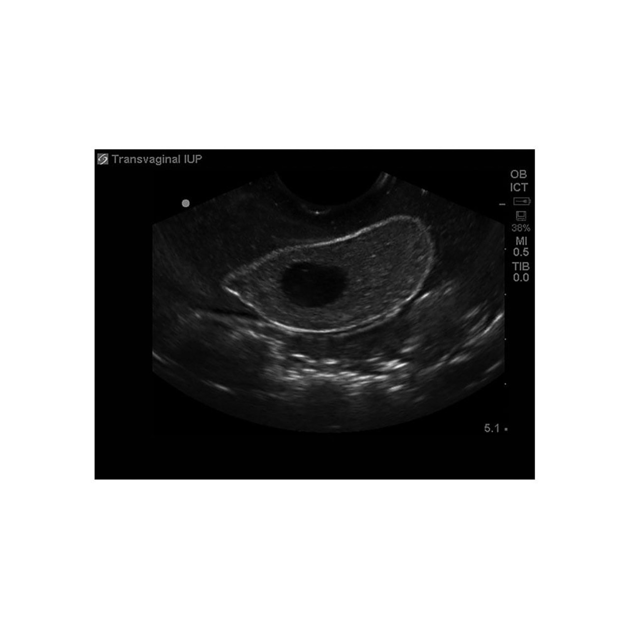 General Pathology Transvaginal Ultrasound Training Model