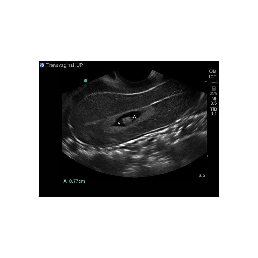 General Pathology Transvaginal Ultrasound Training Model