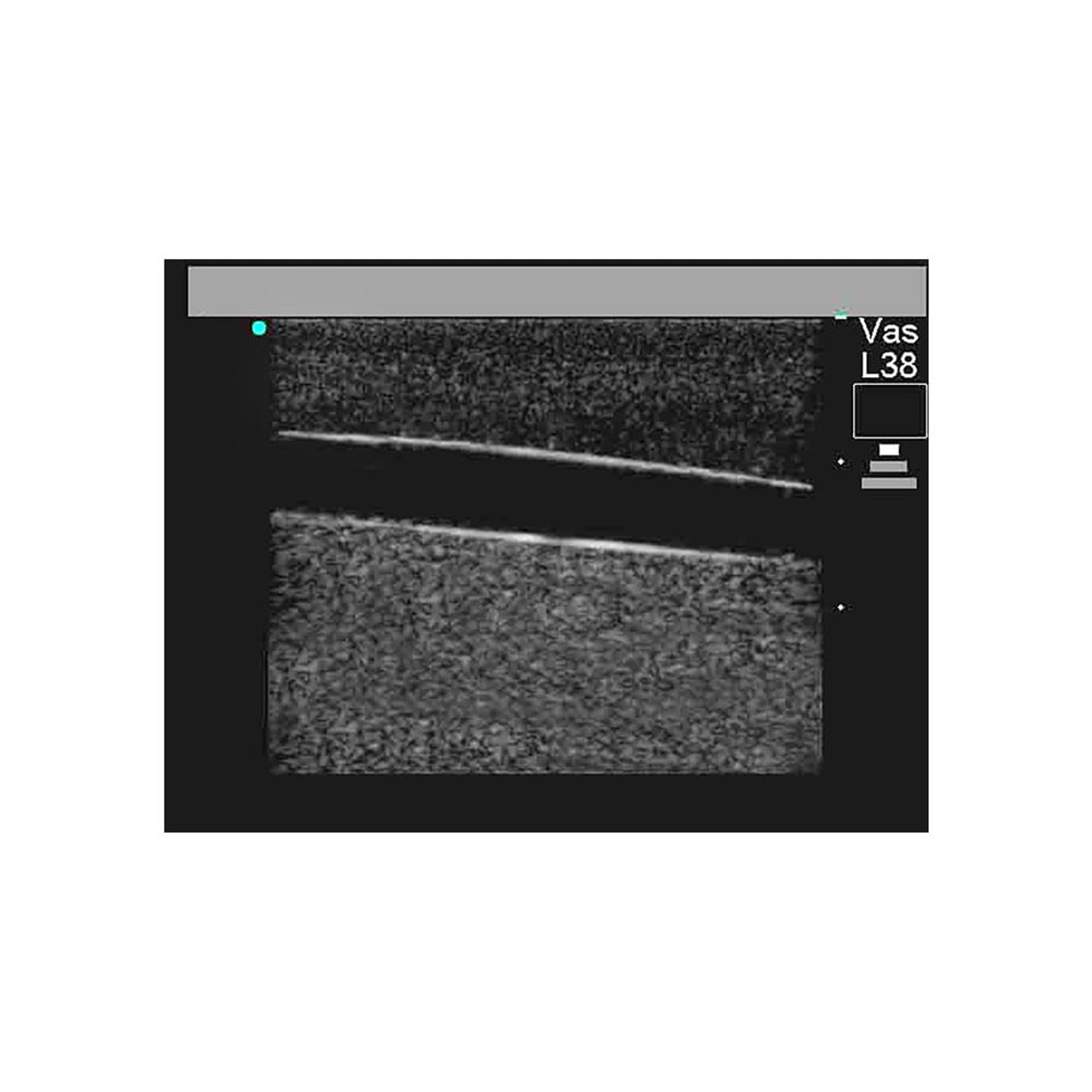 Paracentesis Ultrasound Replacement Tissue Insert