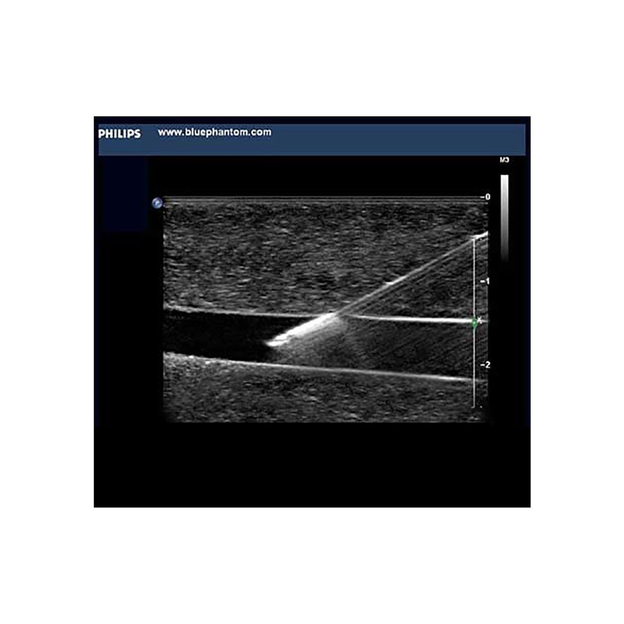 Paracentesis Ultrasound Replacement Tissue Insert
