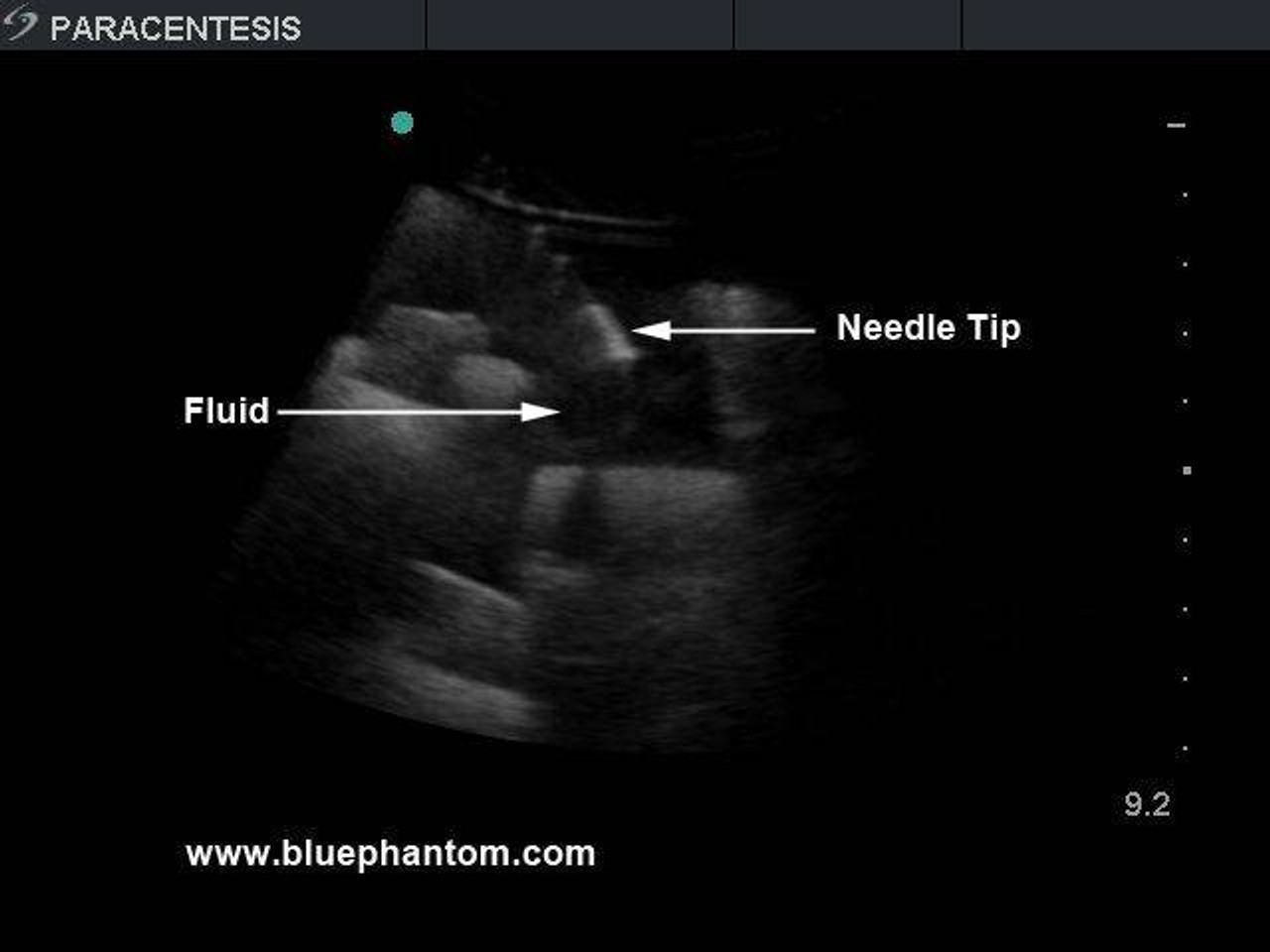 Paracentesis Ultrasound Training Model