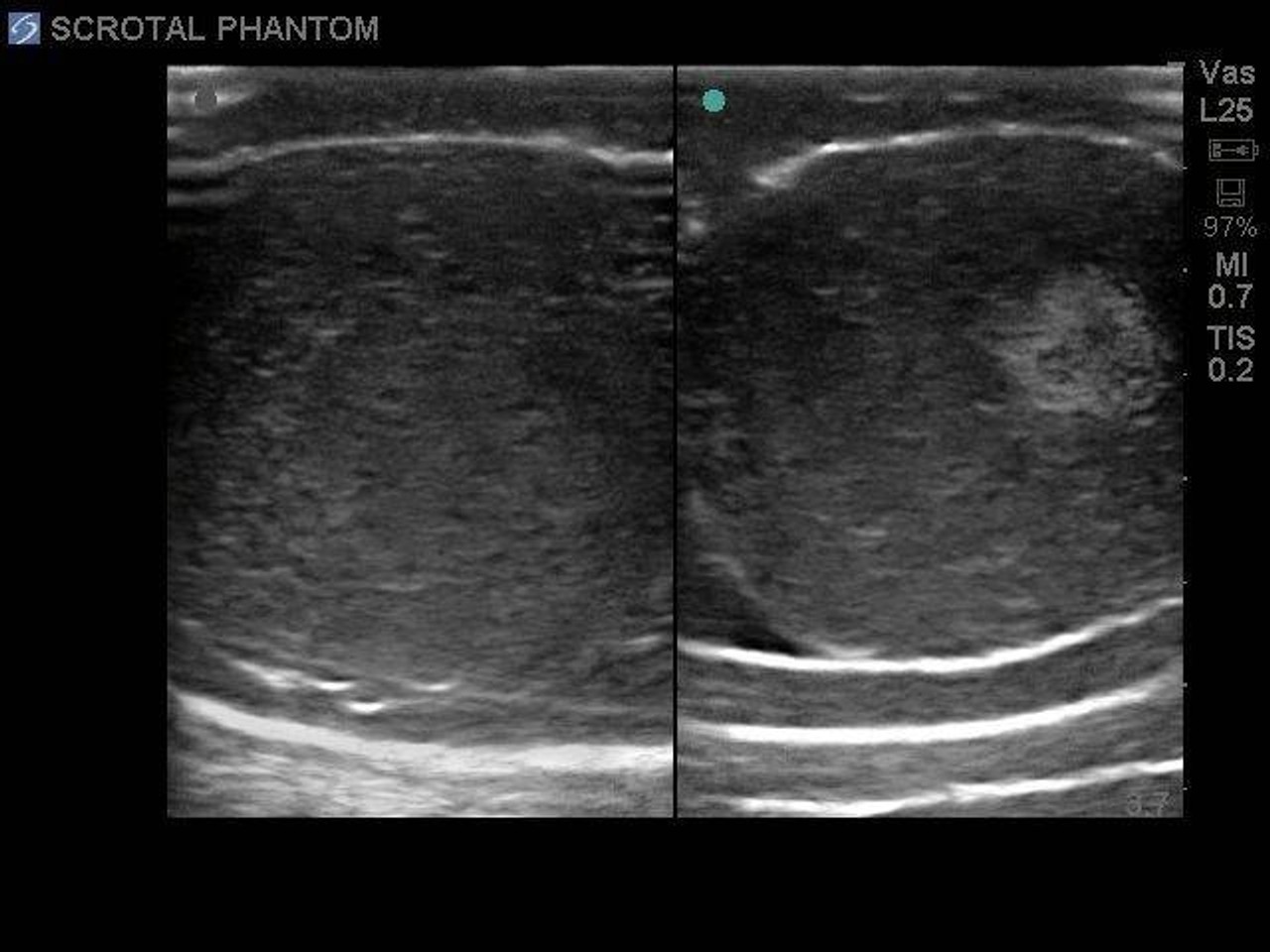 Scrotal Ultrasound Training Model