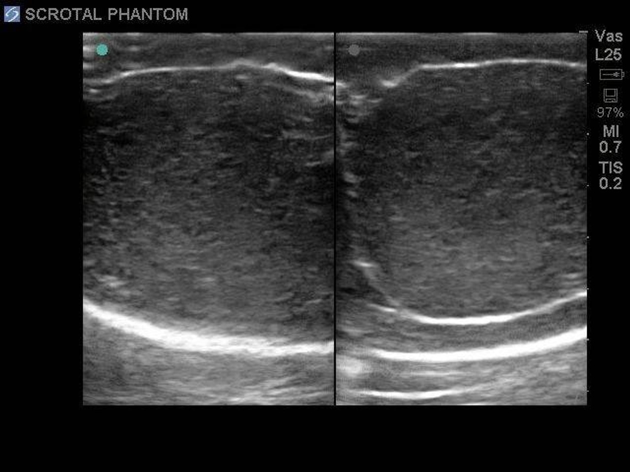 Scrotal Ultrasound Training Model