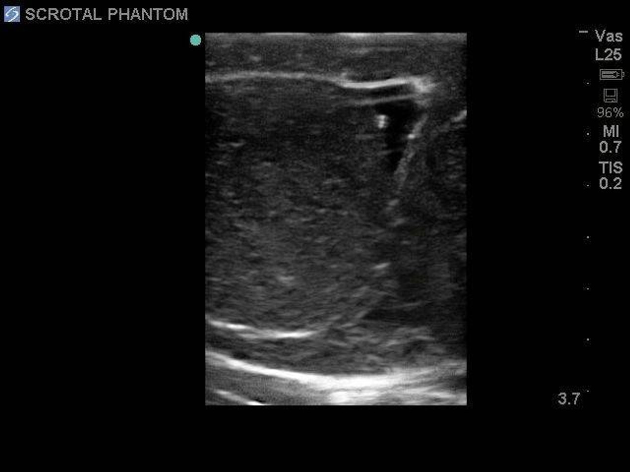 Scrotal Ultrasound Training Model