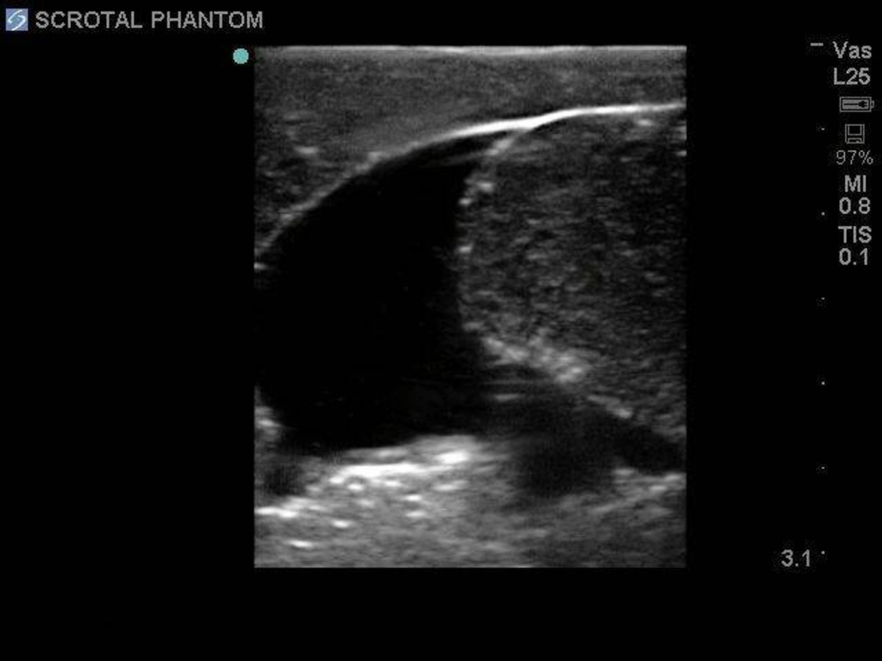 Scrotal Ultrasound Training Model