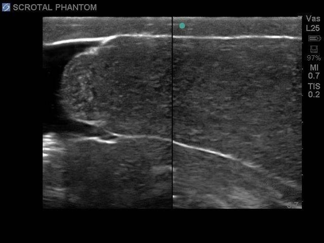 Scrotal Ultrasound Training Model