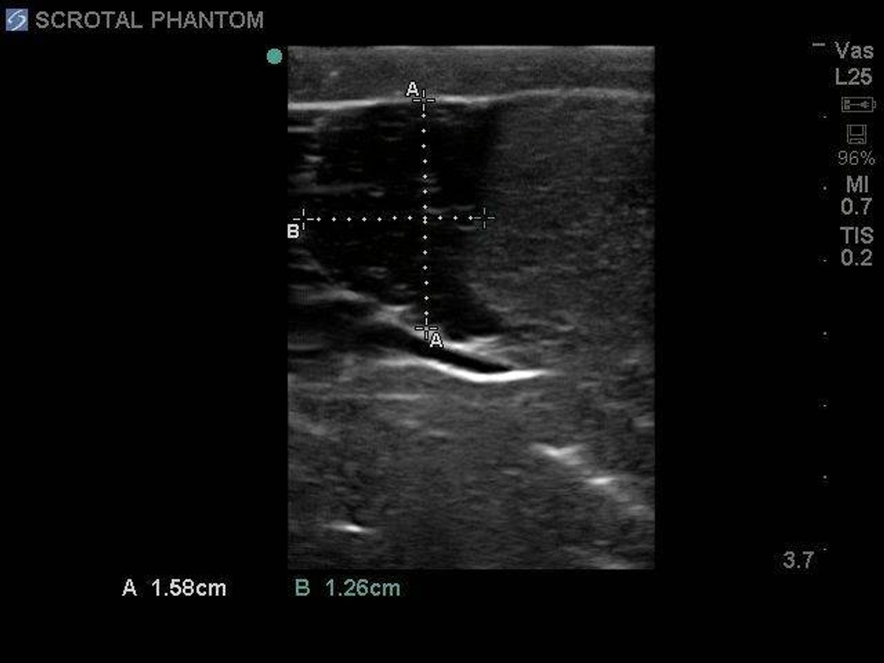 Scrotal Ultrasound Training Model
