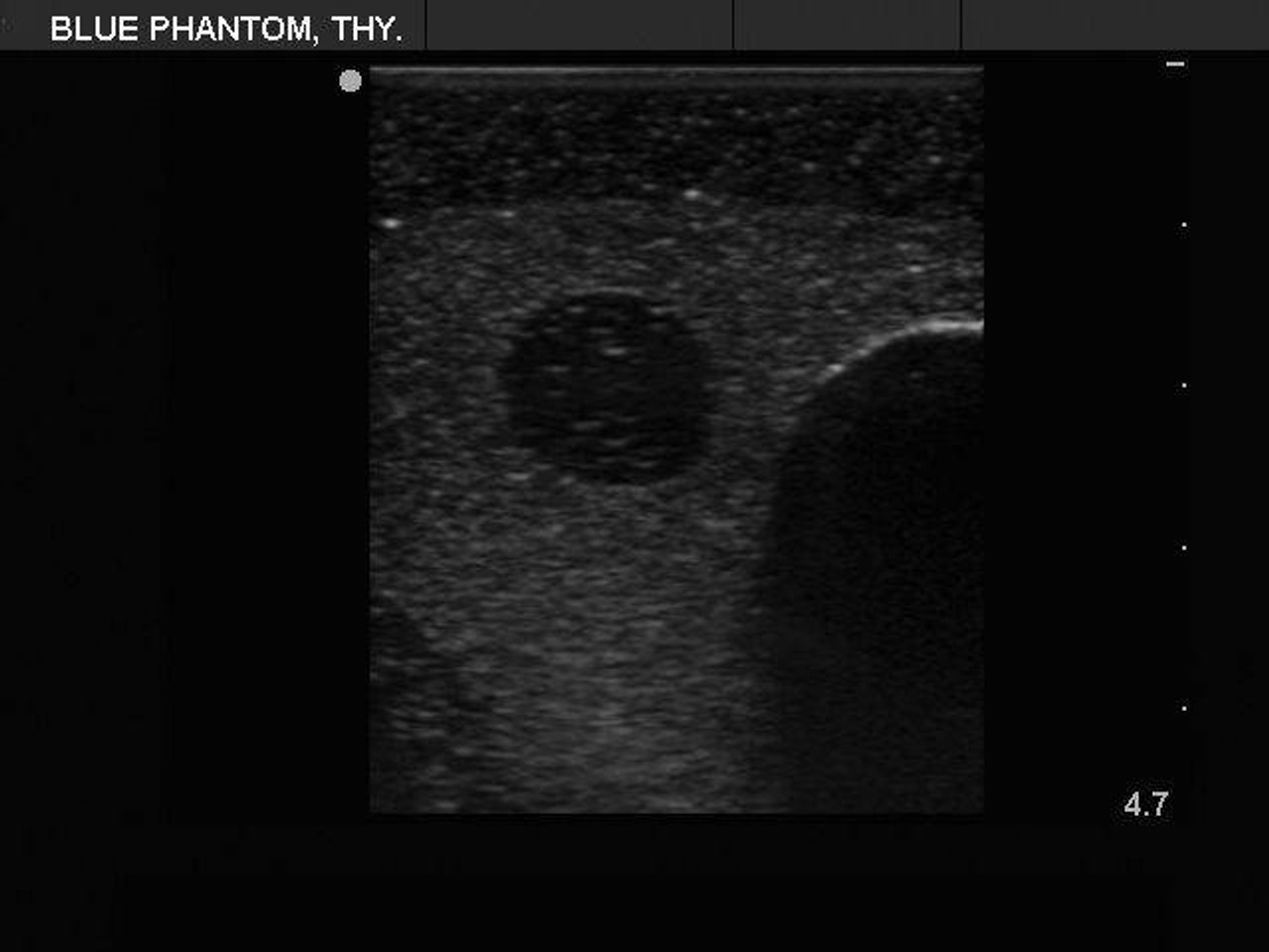 Thyroid Biopsy Ultrasound Training Model