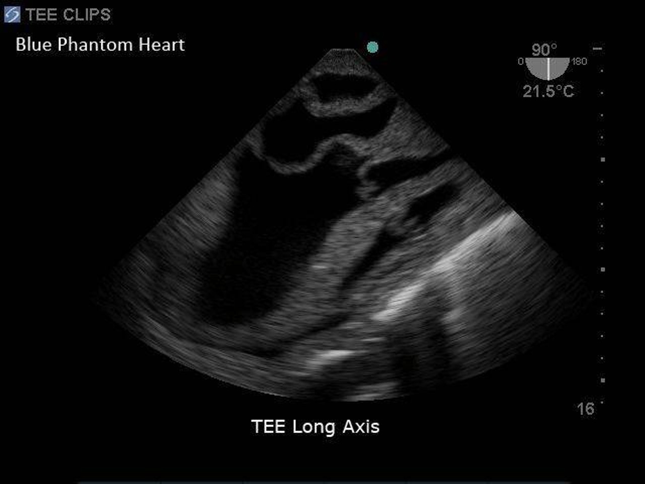 Blue Phantom Transesophageal Echo and Transthoracic Echo