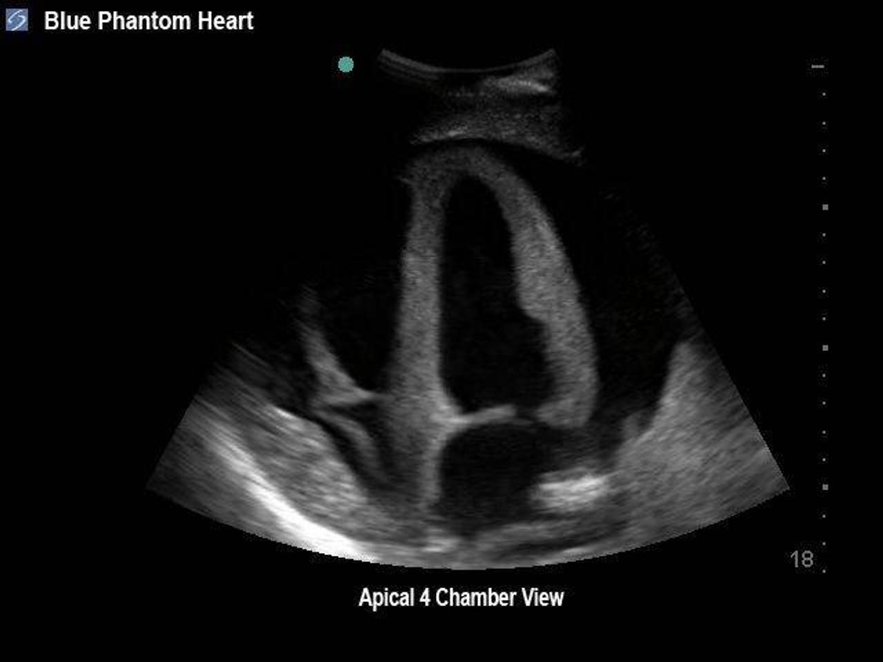 Transesophageal Echo and Transthoracic Echo Training Model