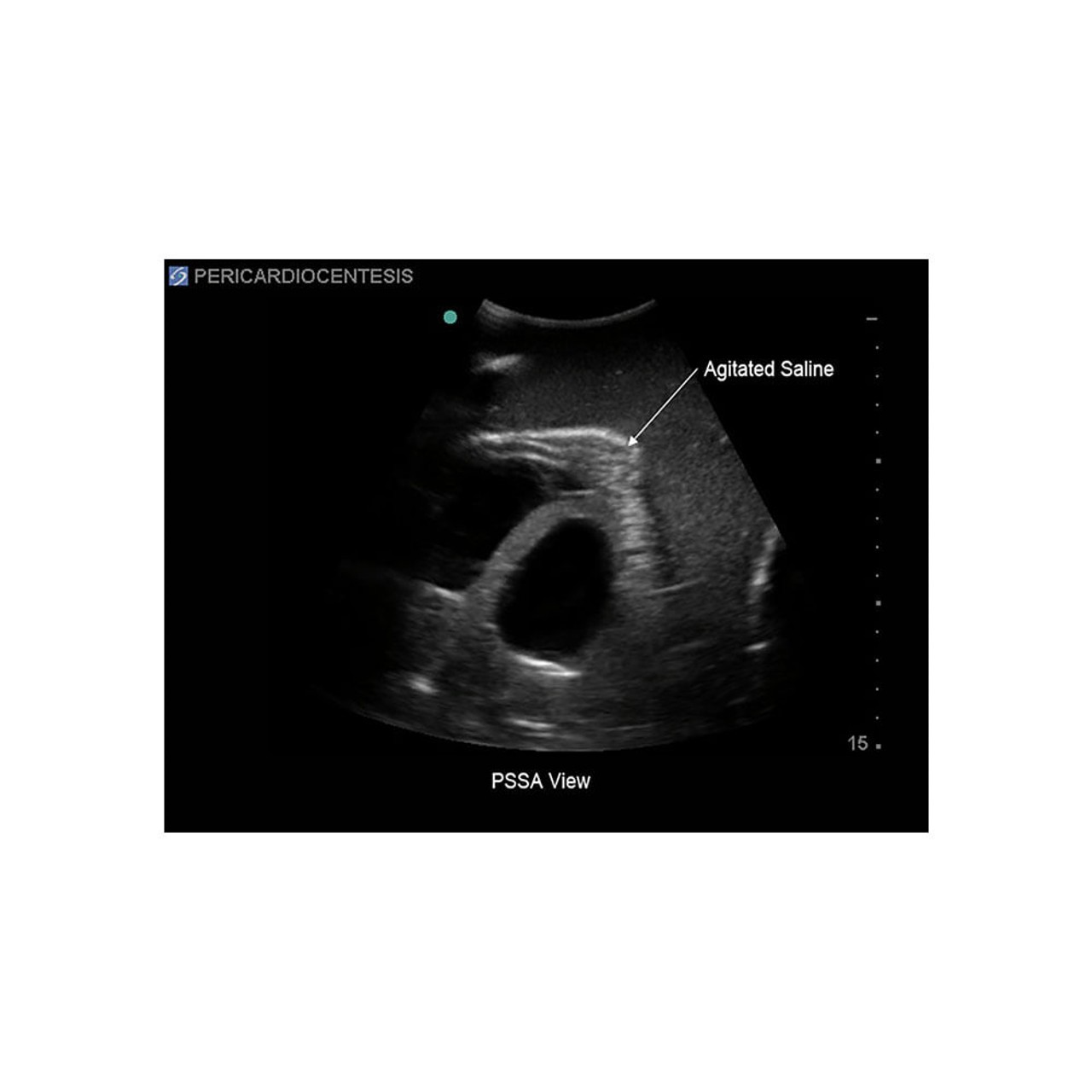 Transesophageal Echo and Transthoracic Echo Training Model
