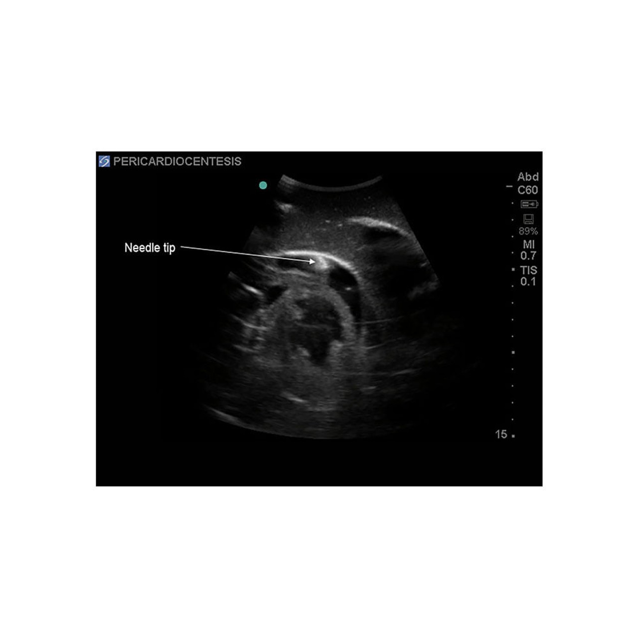 Transesophageal Echo and Transthoracic Echo Training Model