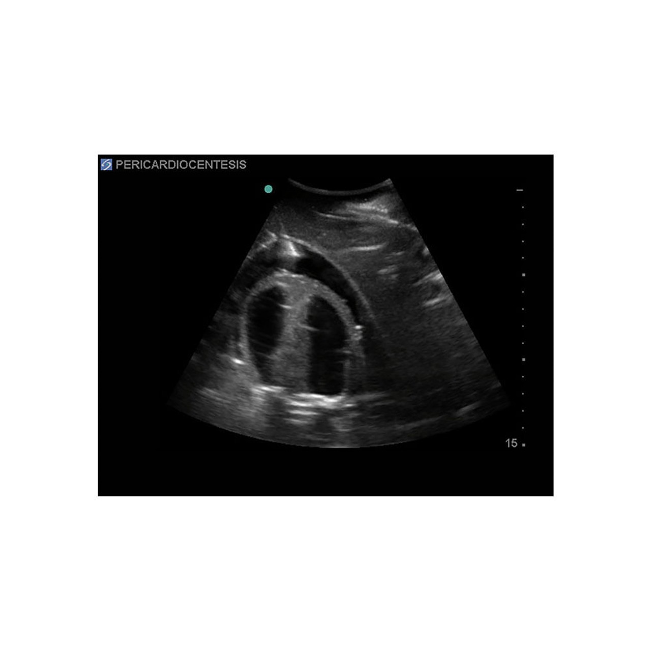 Transesophageal Echo and Transthoracic Echo Training Model