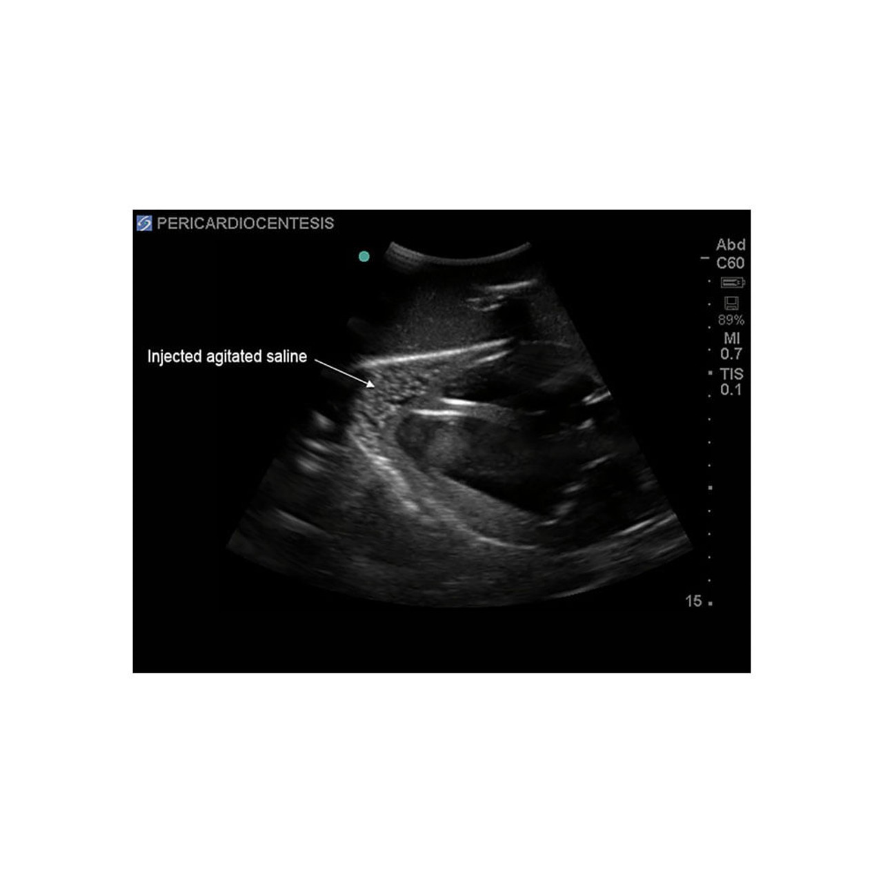 Transesophageal Echo and Transthoracic Echo Training Model