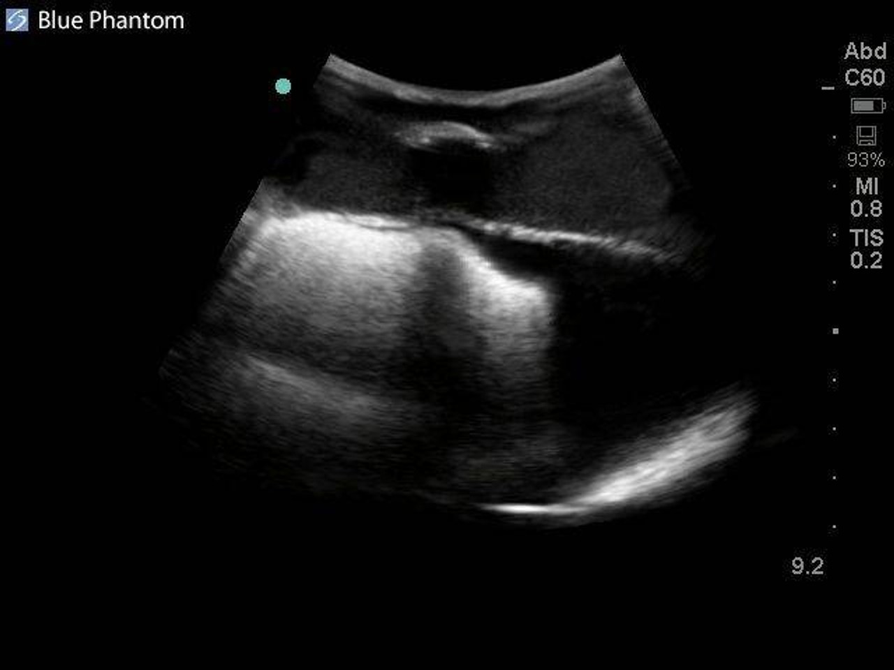 Midscapular Thoracentesis Ultrasound Training Model