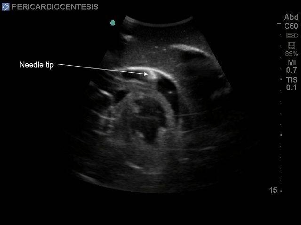 Transthoracic Echocardiography and Pericardiocentesis Ultrasound Training Model