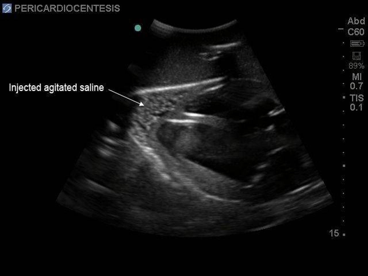 Transthoracic Echocardiography and Pericardiocentesis Ultrasound Training Model