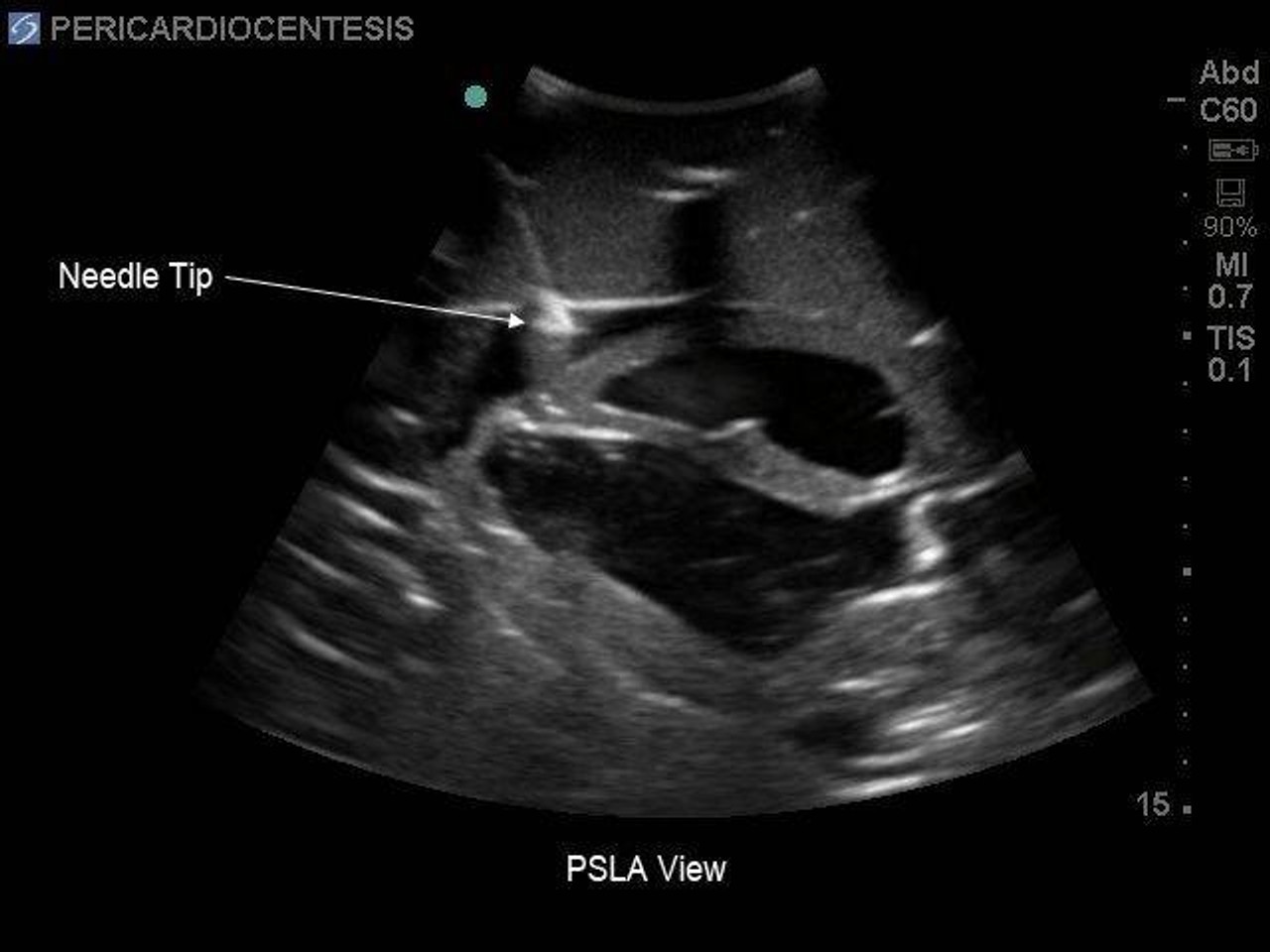 Transthoracic Echocardiography and Pericardiocentesis Ultrasound Training Model