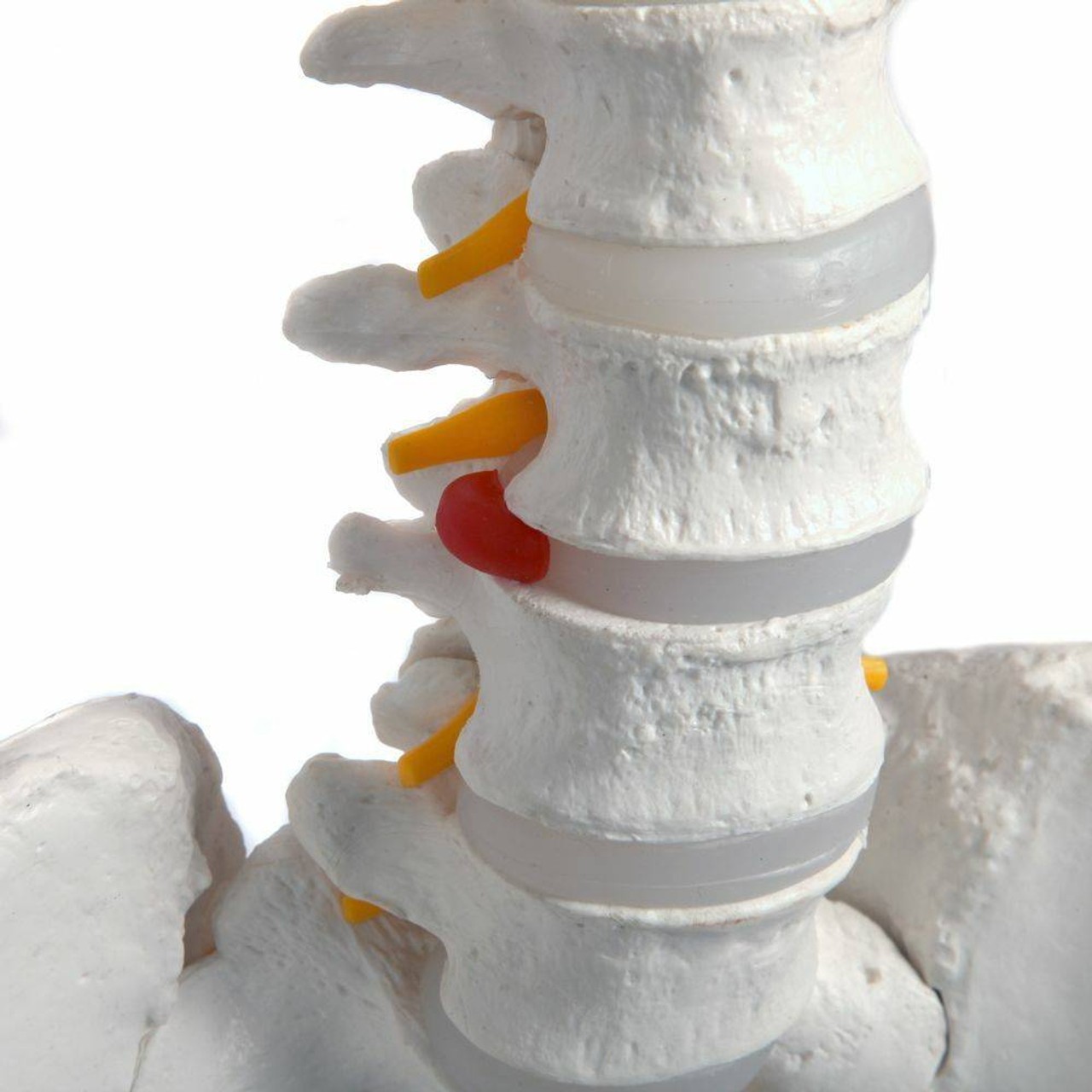 Axis Scientific Classic Life-Size Human Skeleton Anatomy Model with Study Booklet, Numbering Guide, and Hanging Stand Close Up of Herniated Disc