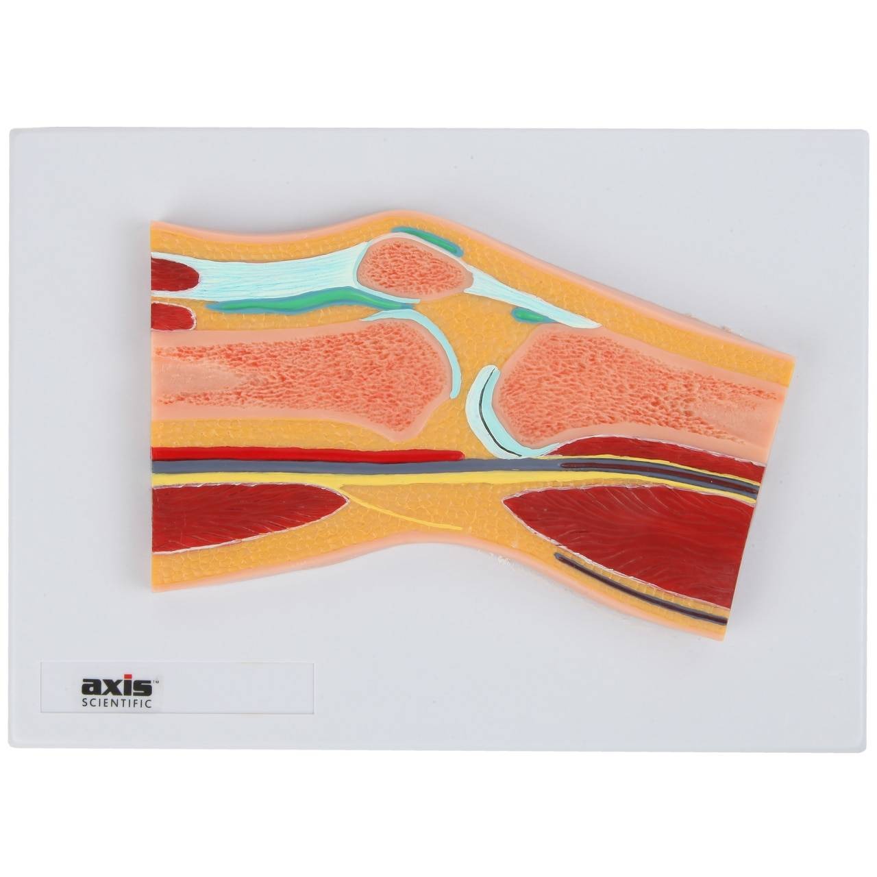 Axis Scientific Knee Joint Section Anatomy Model
