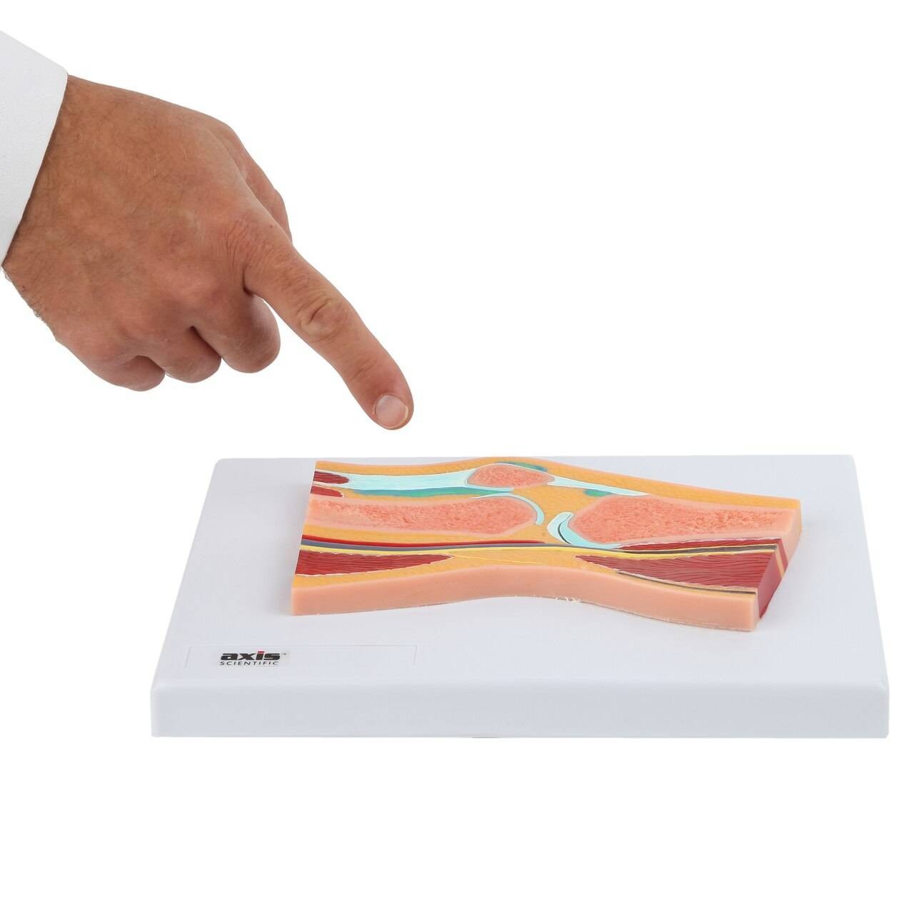 Axis Scientific Knee Joint Section Anatomy Model