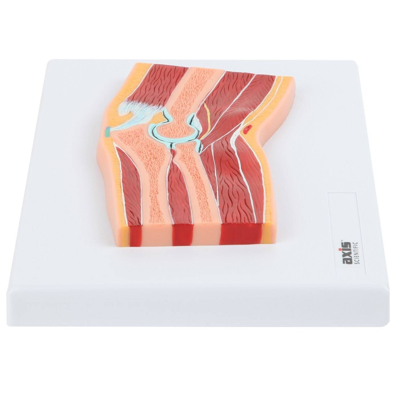 Axis Scientific Elbow Joint Section Anatomy Model