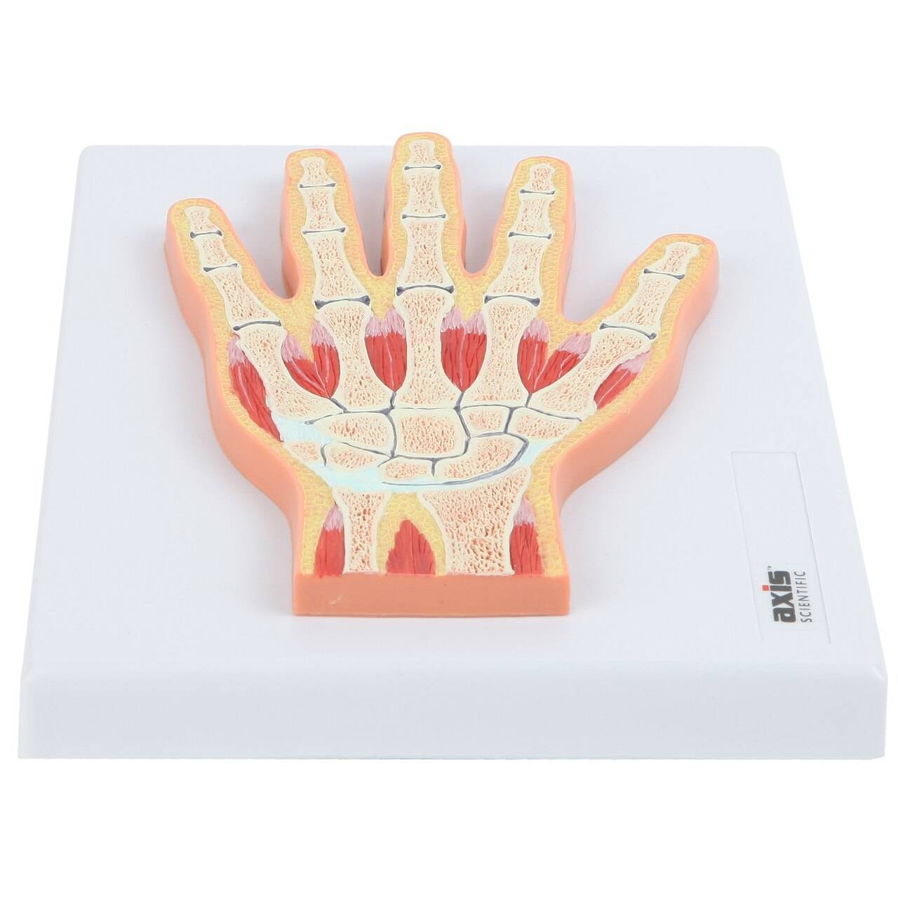 Axis Scientific Hand and Wrist Joint Section Anatomy Model