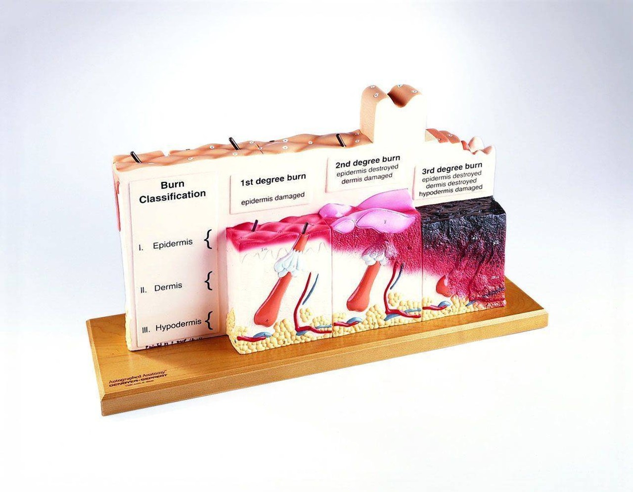 Human Skin Series Plus Burn Pathologies Anatomy Model