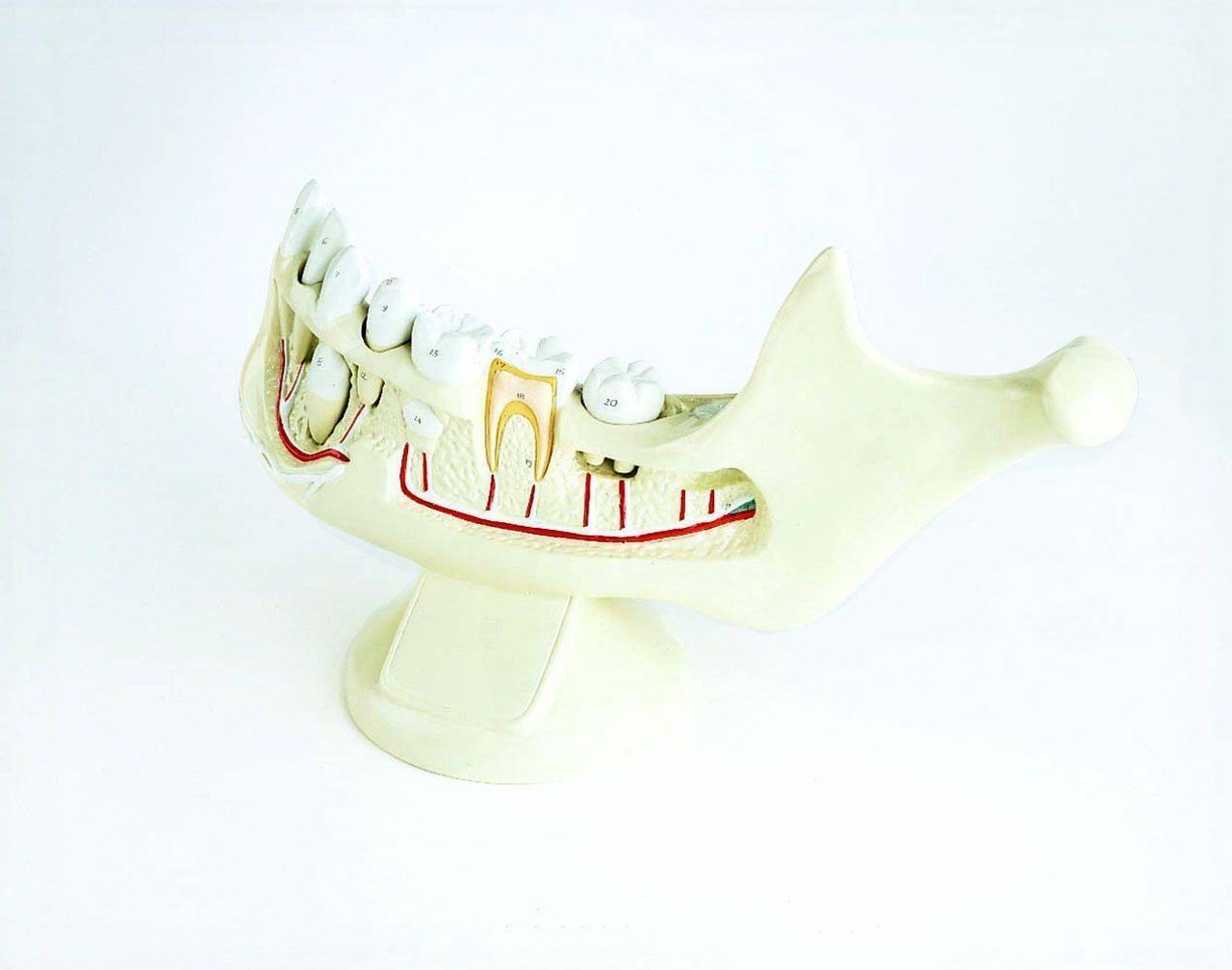 Giant Hands On Childs Jaw Anatomy Model