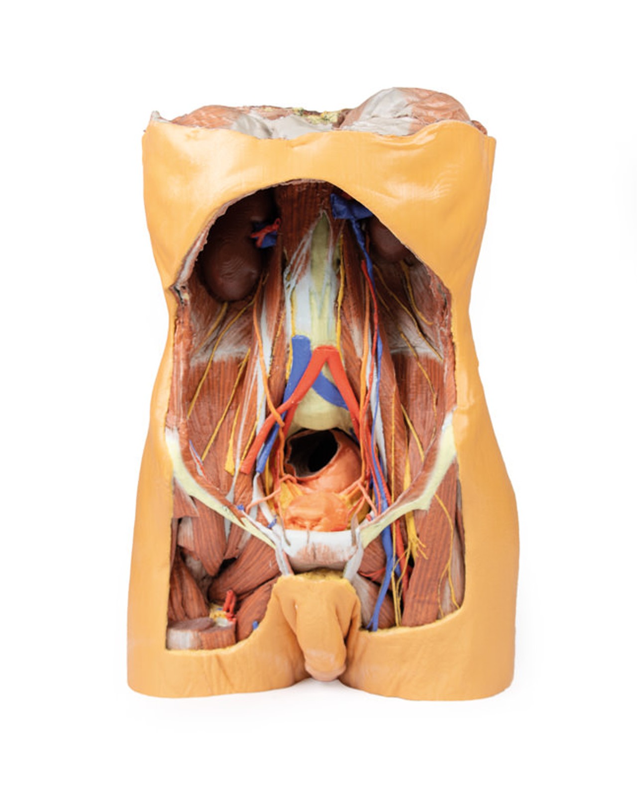 3D Printed Posterior Abdominal wall