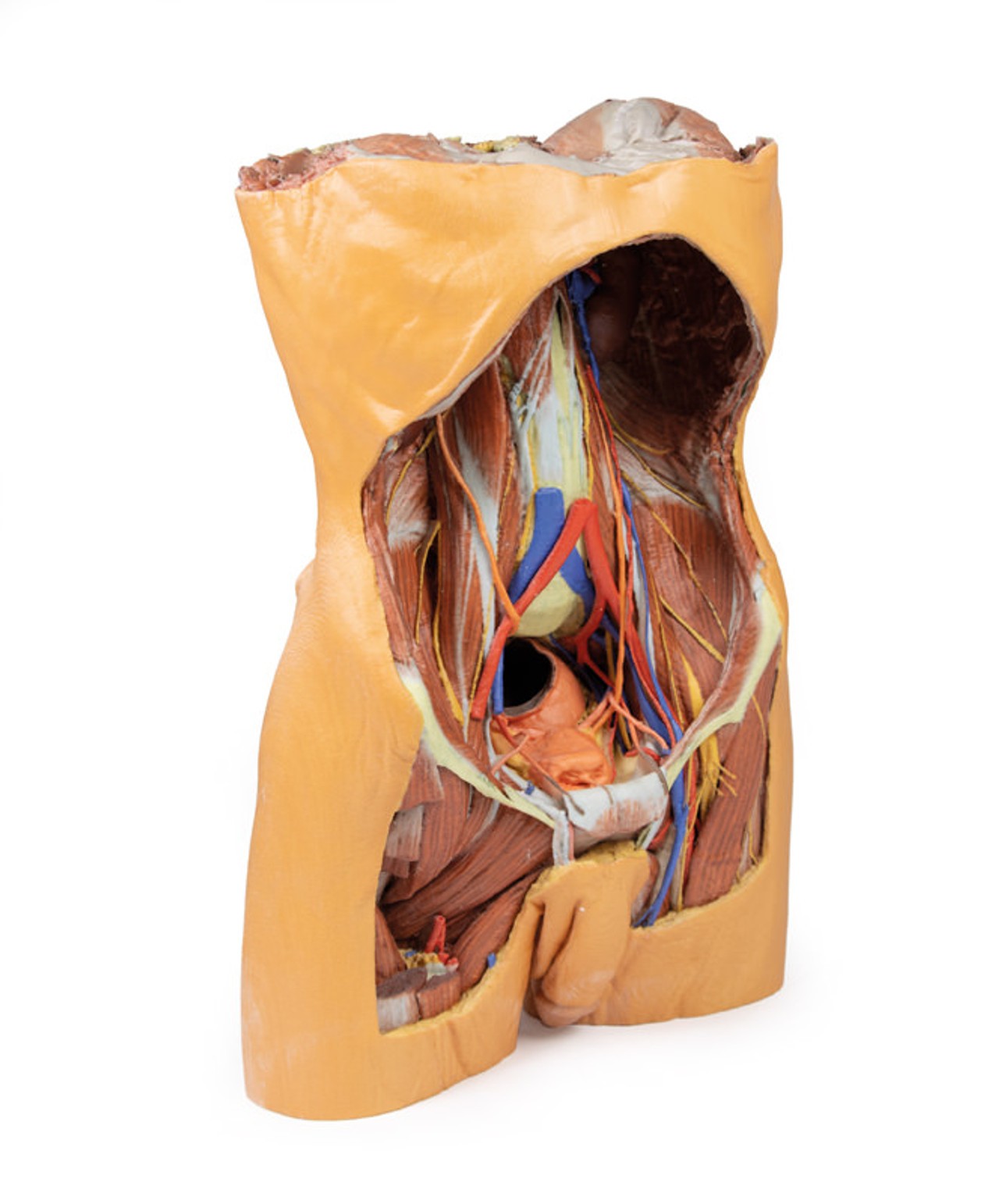 3D Printed Posterior Abdominal wall