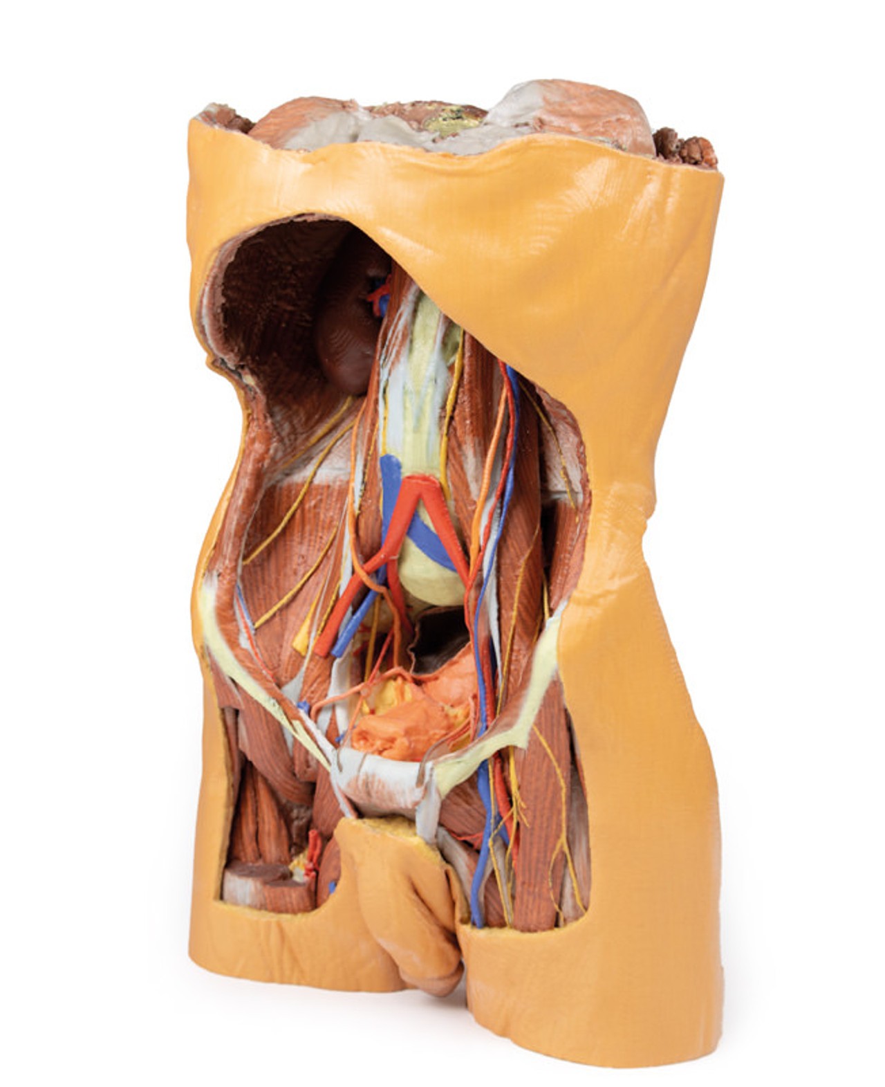 3D Printed Posterior Abdominal wall