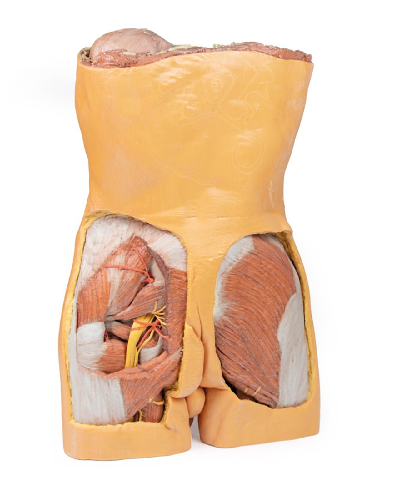 3D Printed Posterior Abdominal wall