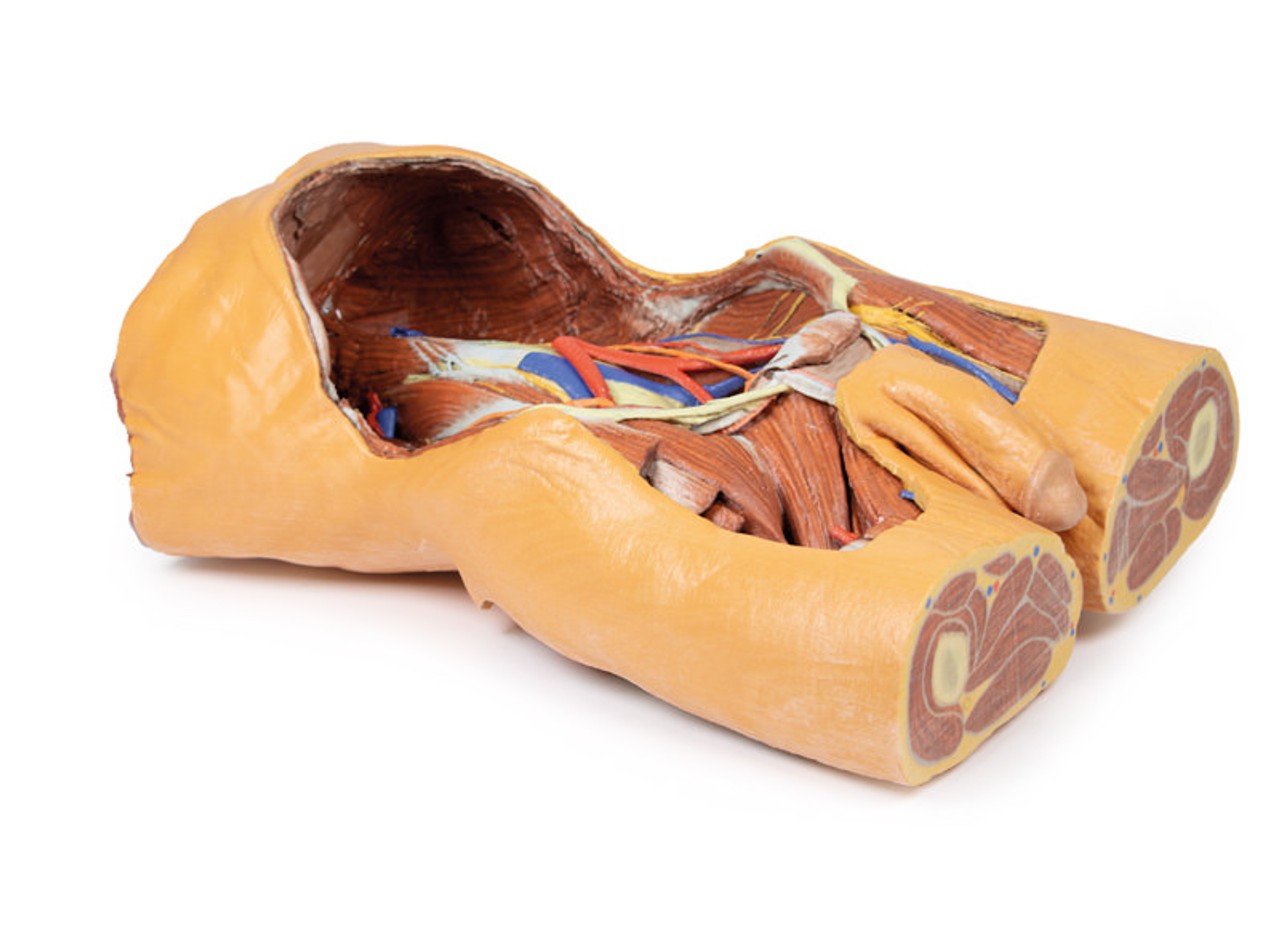 3D Printed Posterior Abdominal wall