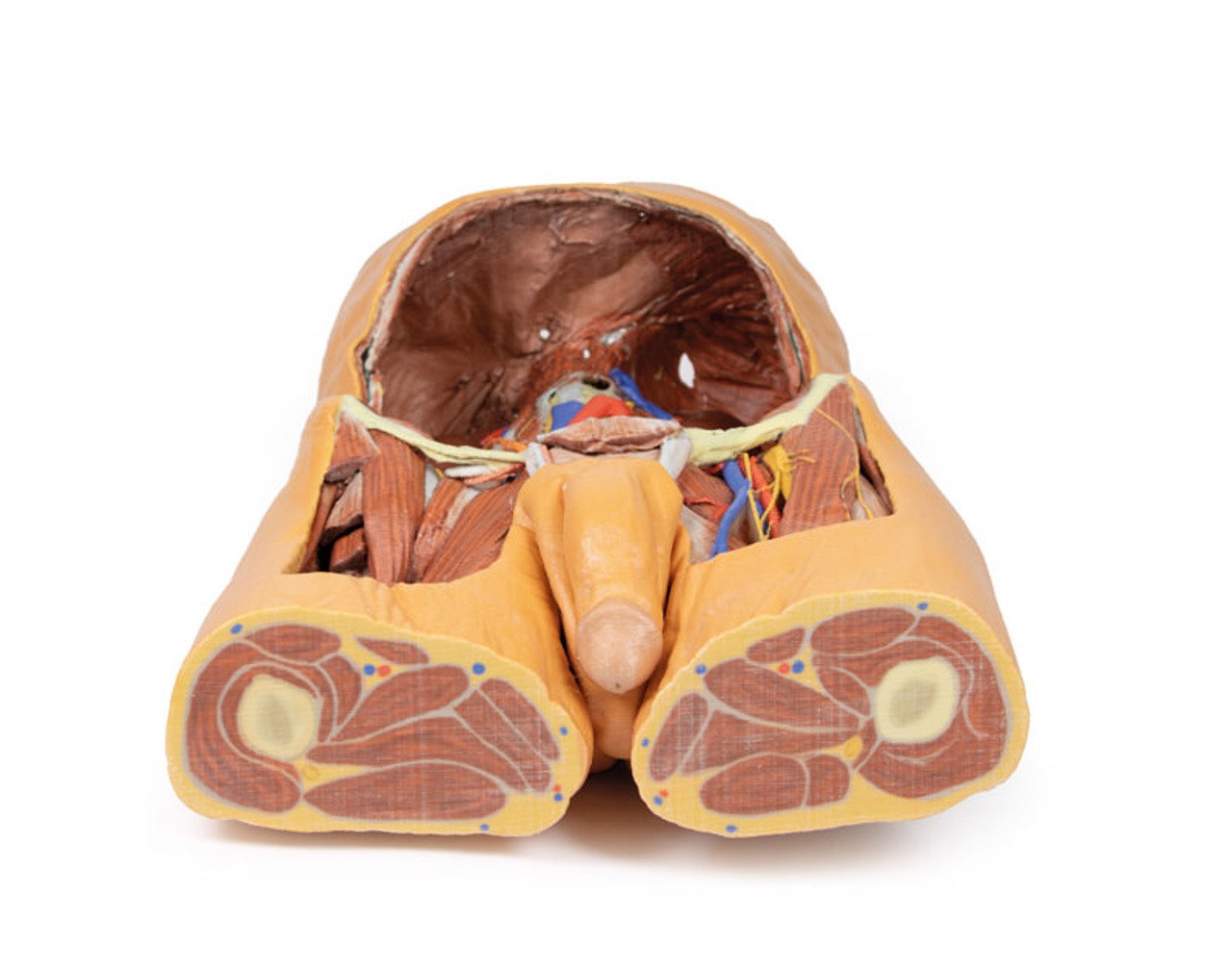 3D Printed Posterior Abdominal wall