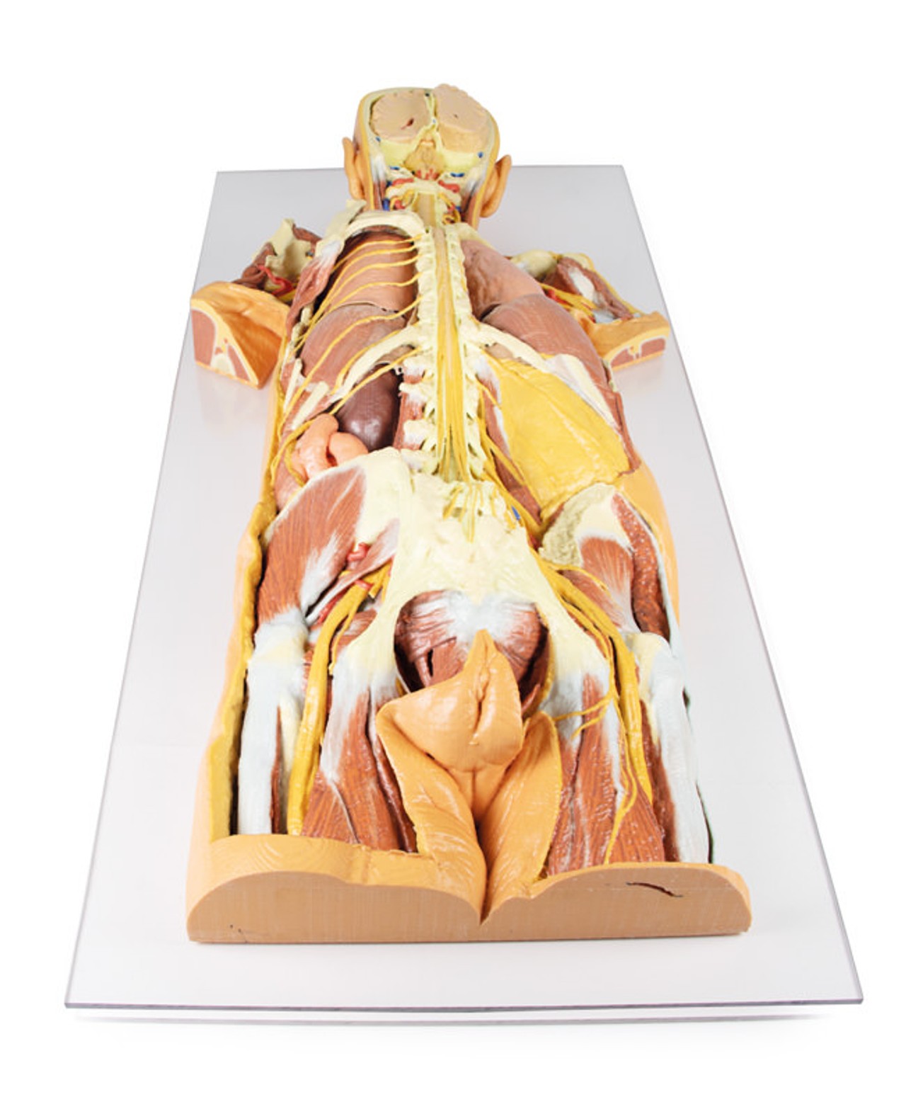 3D Printed Nervous System Dissection (posterior view)