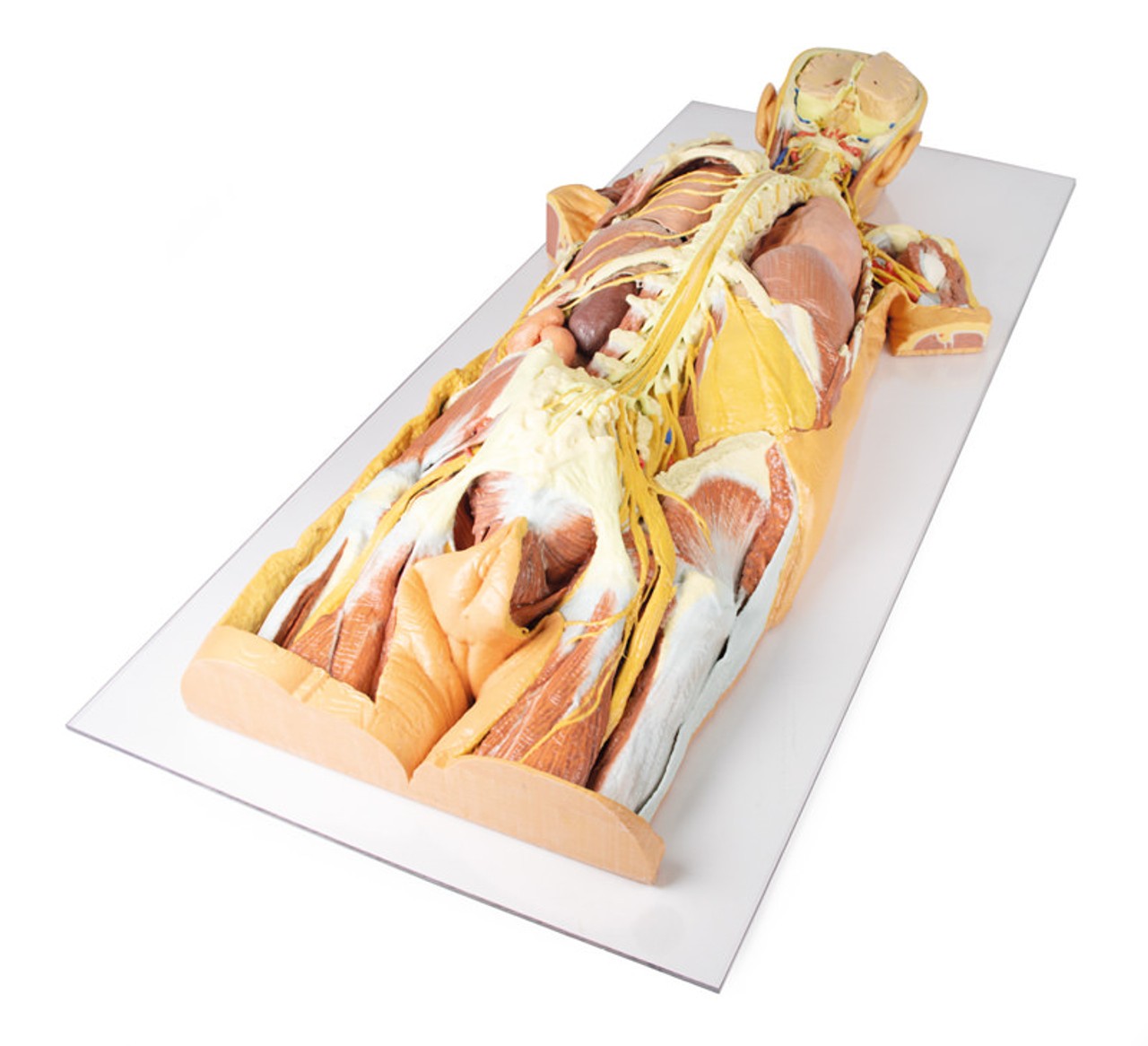 3D Printed Nervous System Dissection (posterior view)
