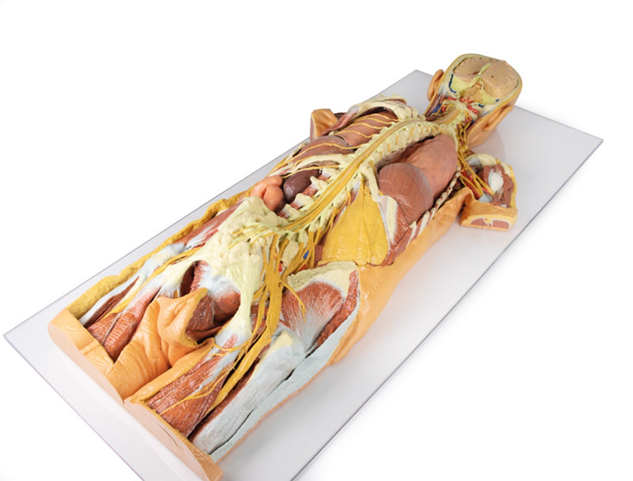 3D Printed Nervous System Dissection (posterior view)
