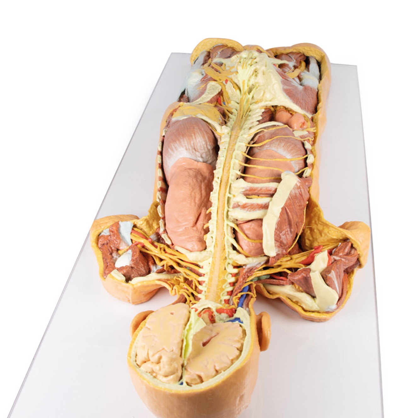 3D Printed Nervous System Dissection (posterior view)