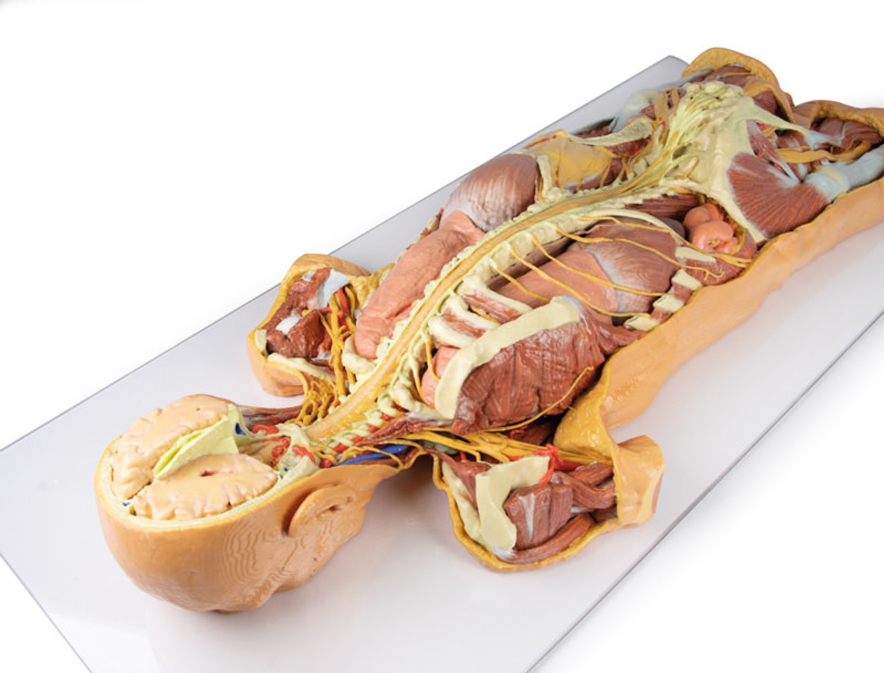 3D Printed Nervous System Dissection (posterior view)