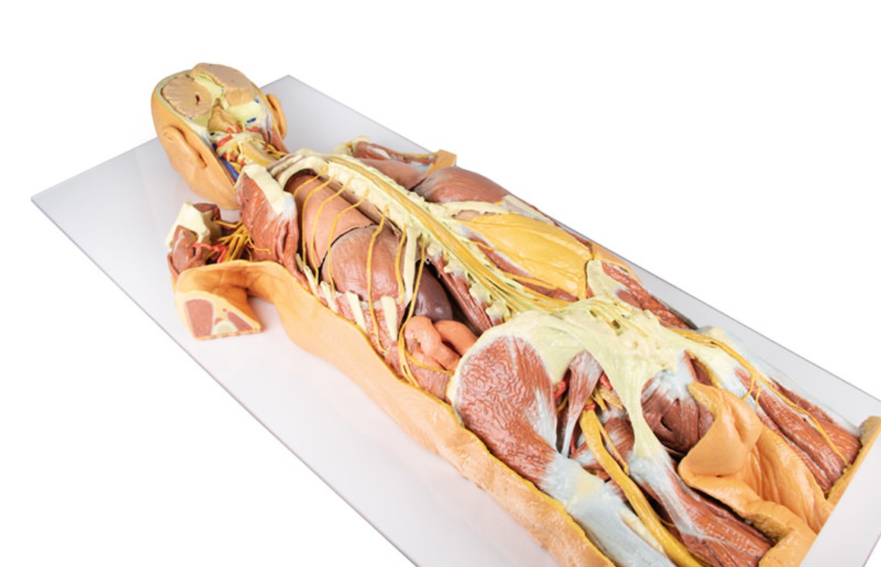 3D Printed Nervous System Dissection (posterior view)