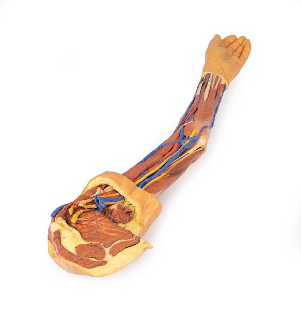 3D Printed Superficial Dissection of the Upper Limb