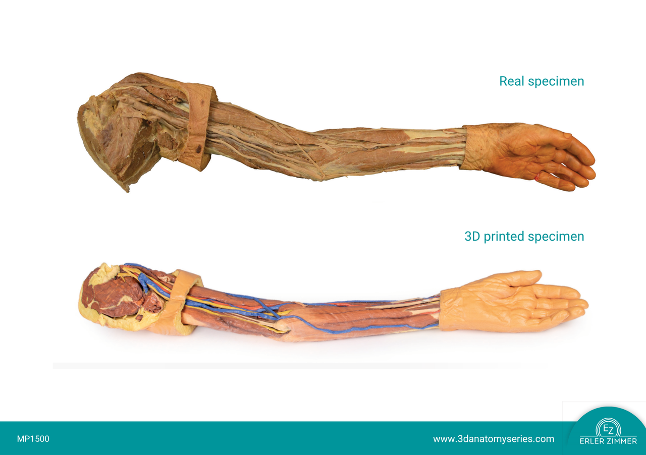 3D Printed Superficial Dissection of the Upper Limb