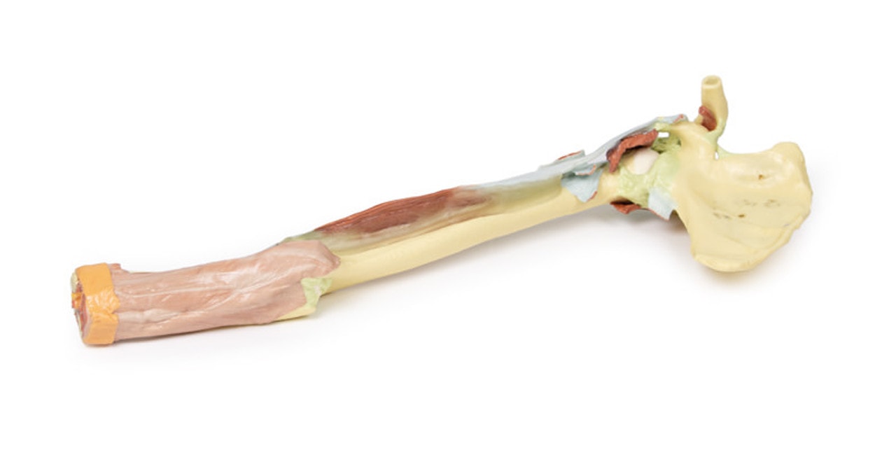 3D Printed Upper Limb - Biceps, Bones and Ligaments