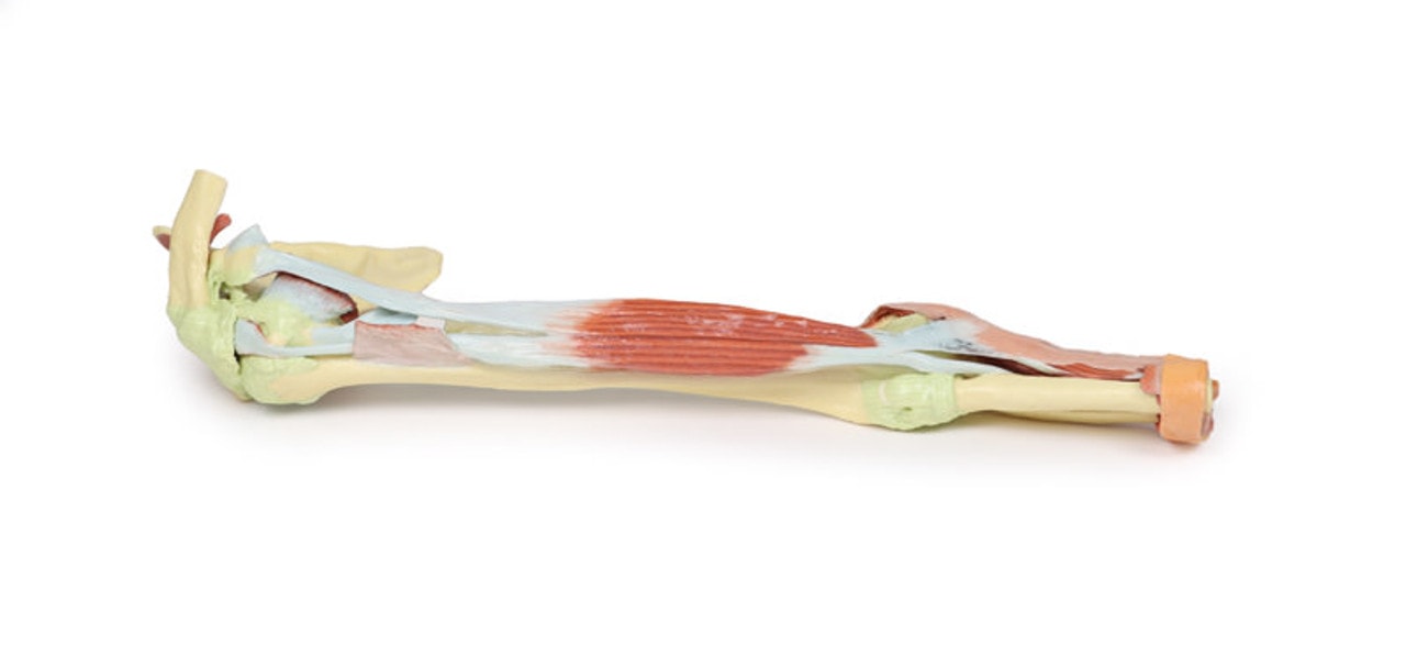 3D Printed Upper Limb - Biceps, Bones and Ligaments